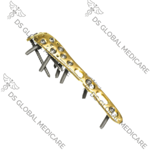 LCP Olecranomn Plate 3.5mm